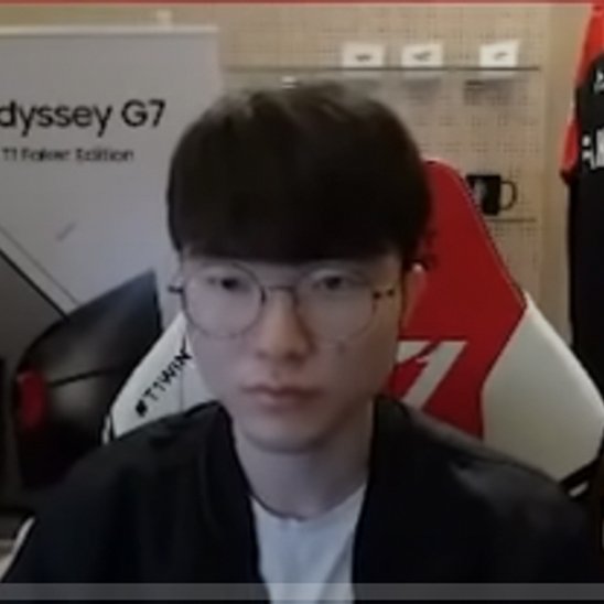 T1 Faker Stream On Hold During Injury Recovery